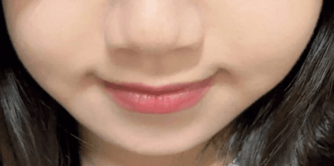 안양울쎄라 잘하는 곳 추천 부탁드려요 1