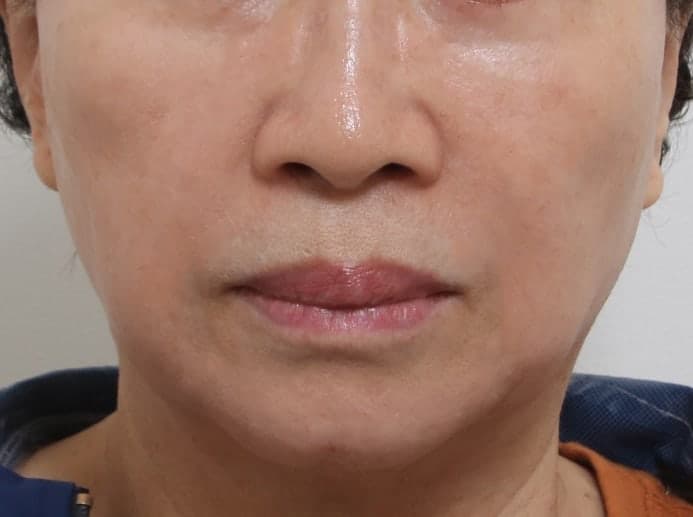 중안부거상 효과 체감 엄청 크시다고 하네요 3