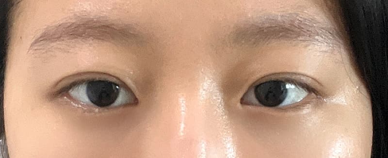올영 컨실러 다 사본 사람이 쓰는 ㅇㅂㅈ 김현조 원장님 눈밑지 후기 2