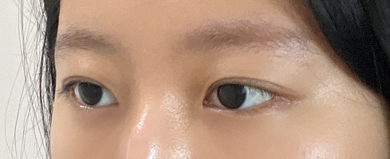 올영 컨실러 다 사본 사람이 쓰는 ㅇㅂㅈ 김현조 원장님 눈밑지 후기 3