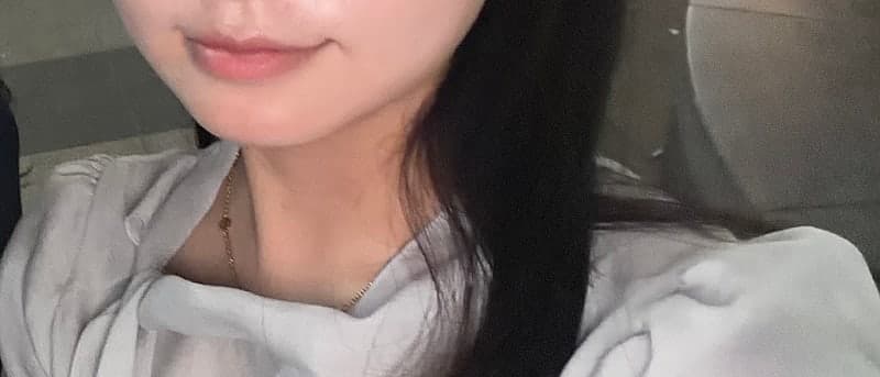 구월동 올타이트리프팅 후기, 생각보다 만족스러웠던 리프팅 시술 9