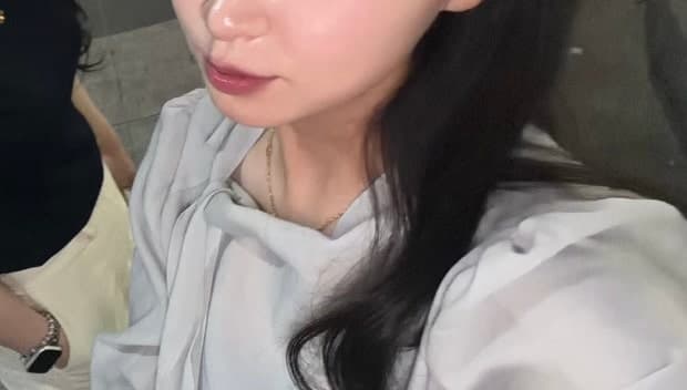 구월동 올타이트리프팅 후기, 생각보다 만족스러웠던 리프팅 시술 10