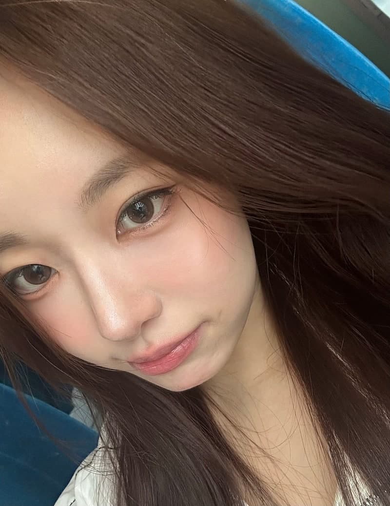얼굴지방흡입 이중턱 붓기 정리한 후기! 2