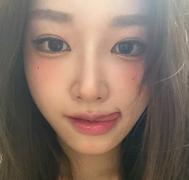 얼굴지방흡입 이중턱 붓기 정리한 후기! 4