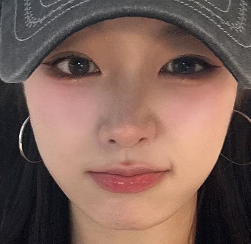 얼굴지방흡입 이중턱 붓기 정리한 후기! 5