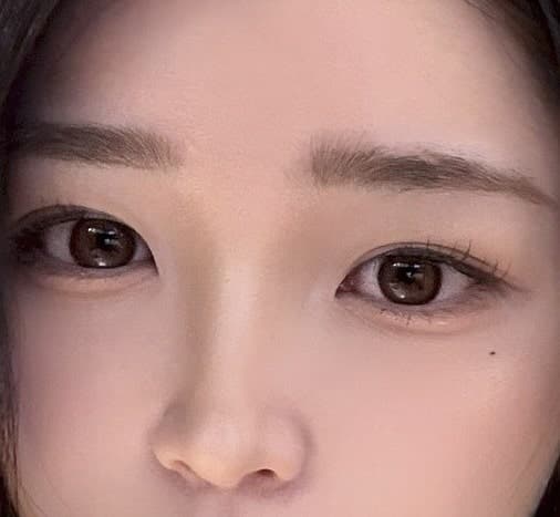 아이 슈링크 유니버스 100샷 효과있을까? 3