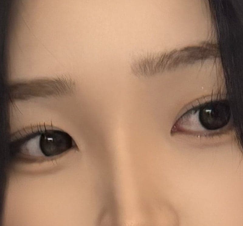 아이 슈링크 유니버스 100샷 효과있을까? 4