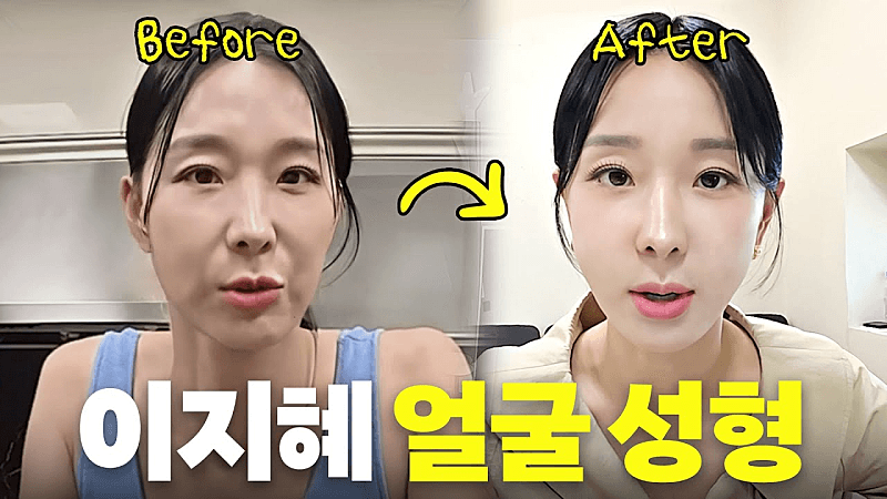 구월동피부과 추천 좀요ㅠㅠ 1