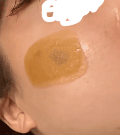 대구리팟레이저 개발하신분한테 흑자제거했어요 ㄷㄷ 1