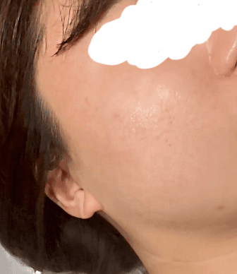 대구리팟레이저 개발하신분한테 흑자제거했어요 ㄷㄷ 2