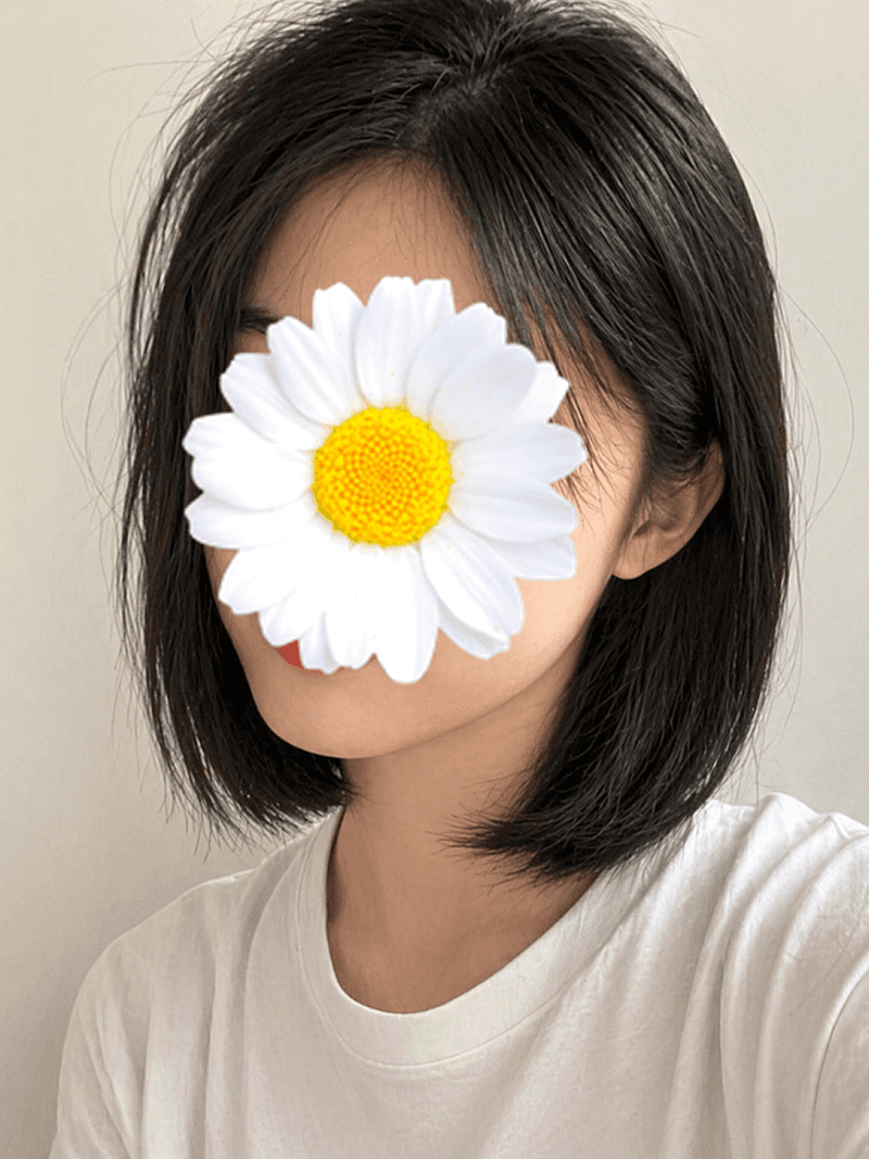 압구정윤곽주사 하려다 비에체피부과 상담 받고 필러해봤더요>< 1