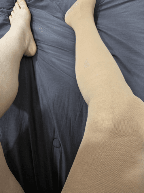 하지정맥류수술후기+ 수원 하지정맥류병원 추천 1