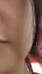 청주온다리프팅 어디가 잘하나요? 1