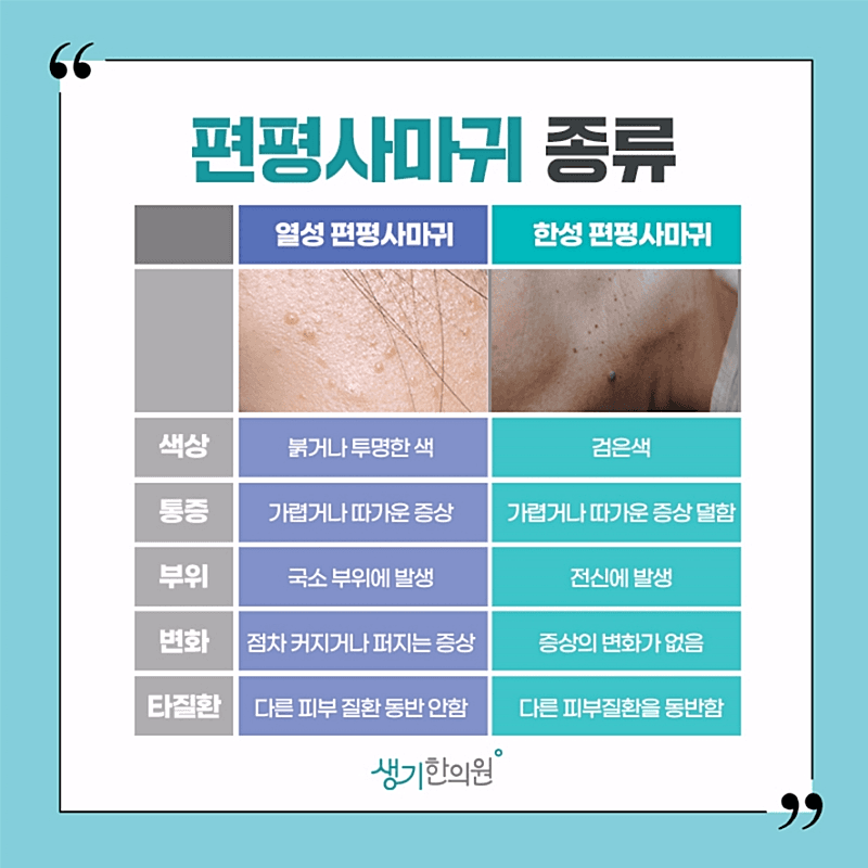 편평사마귀 흉터 걱정 없는 정밀 치료로 관리해보세요! 3