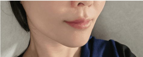 프로필 촬영 디데이 5일에 티타늄 받아도 되나 했는데요ㅋㅋ 1