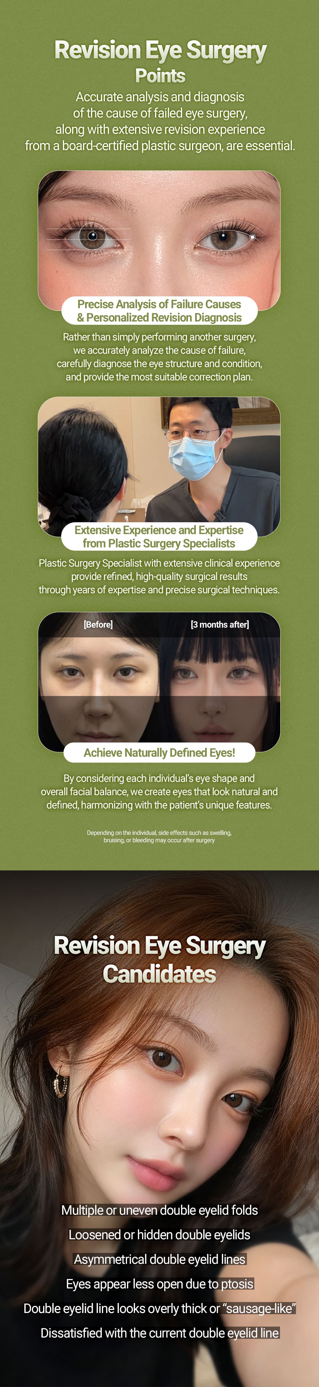 (Non Incision) Revision Double eyelid Surgery 3