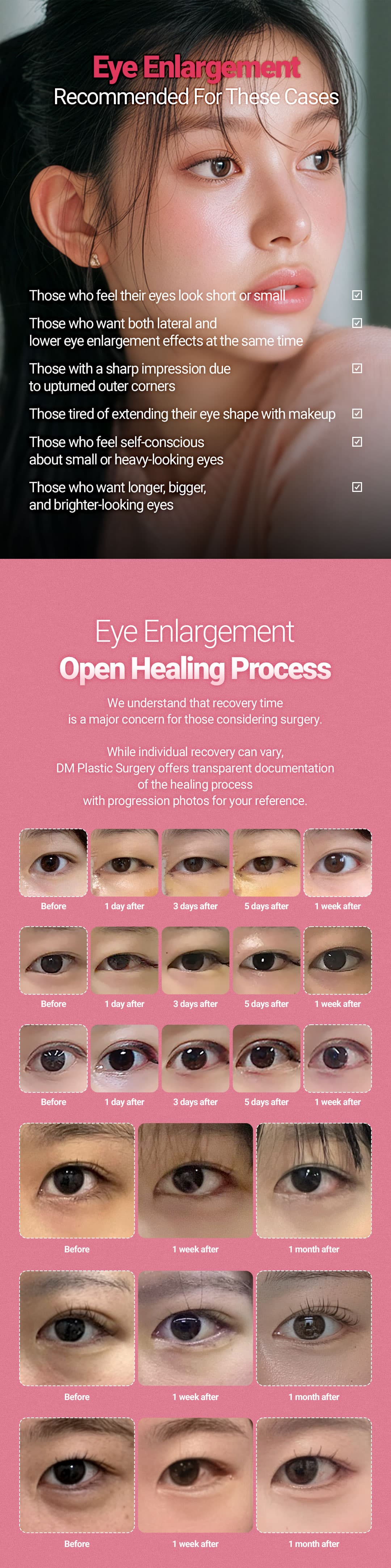 Eye Enlargement 2