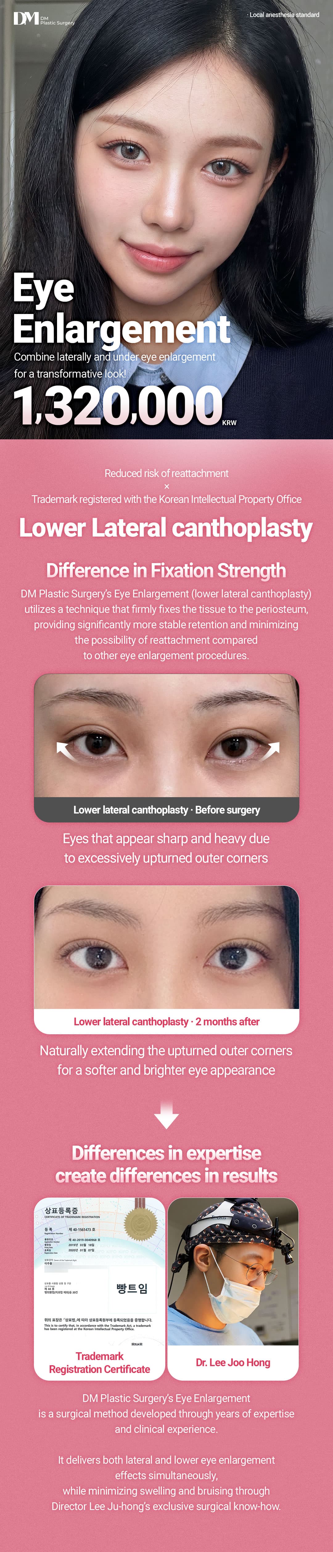 Eye Enlargement 3
