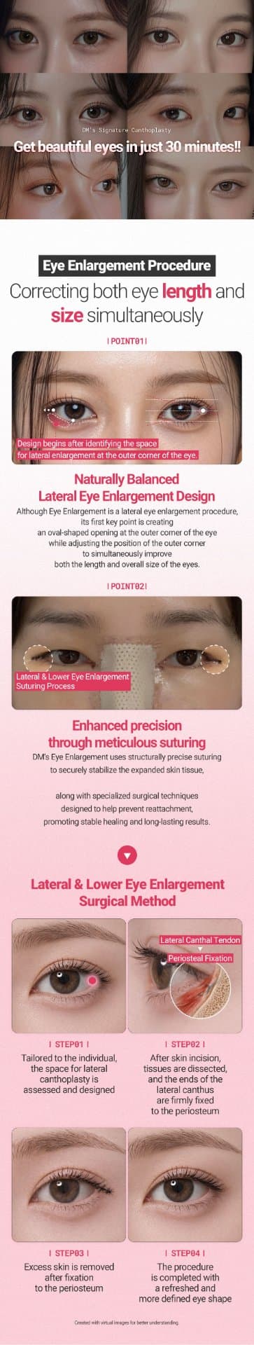 Eye Enlargement 1