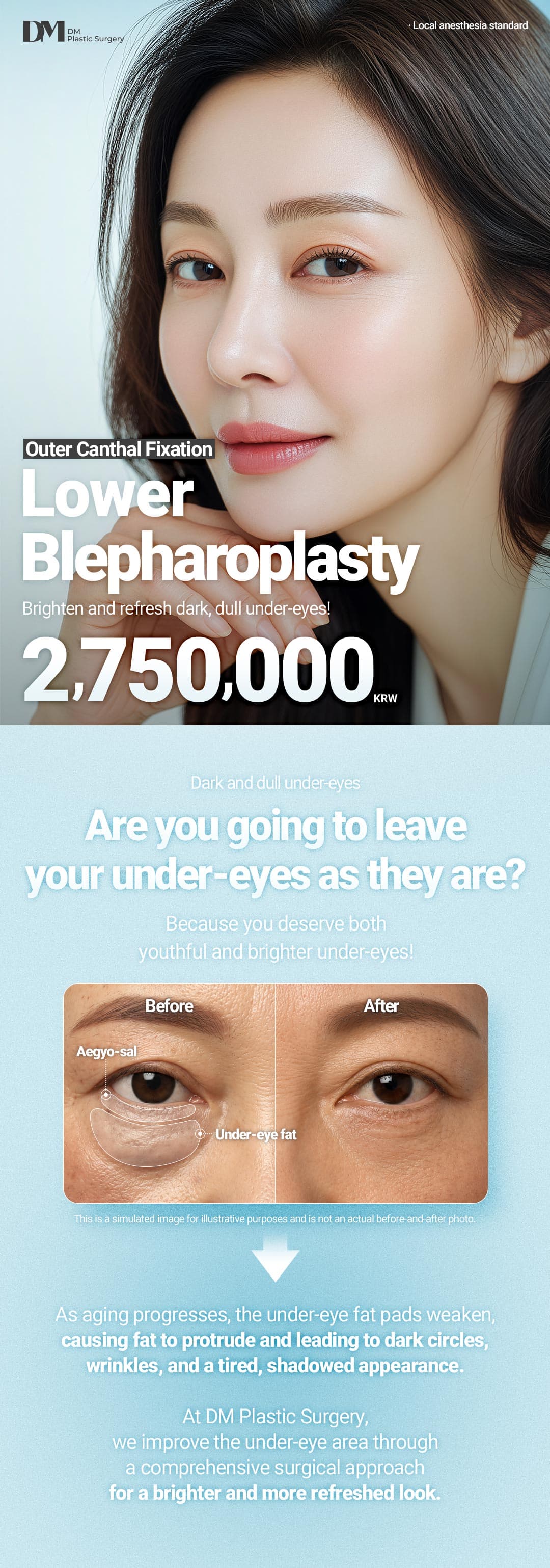 Lower Blepharoplasty 1