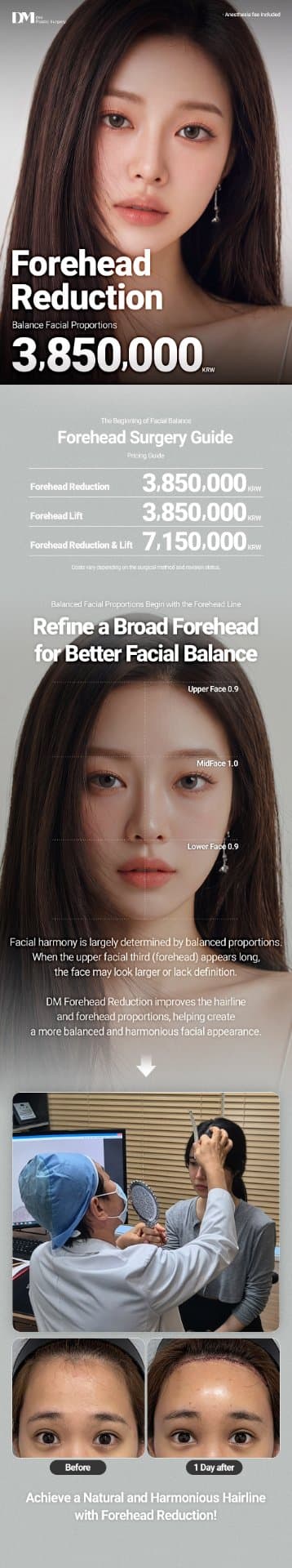 Forehead Reduction 1