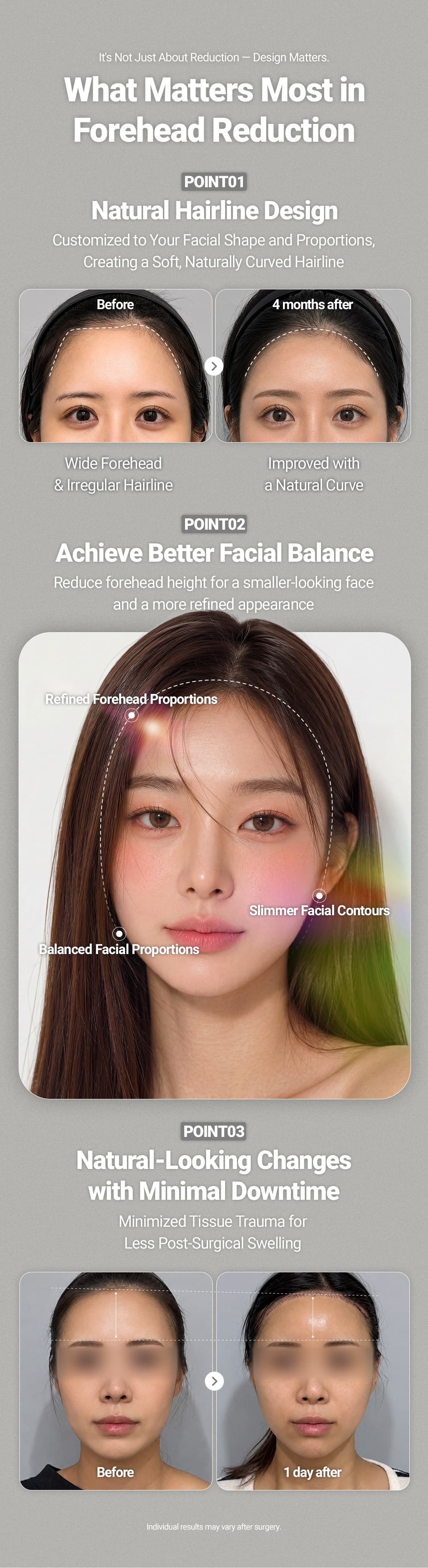 Forehead Reduction 2