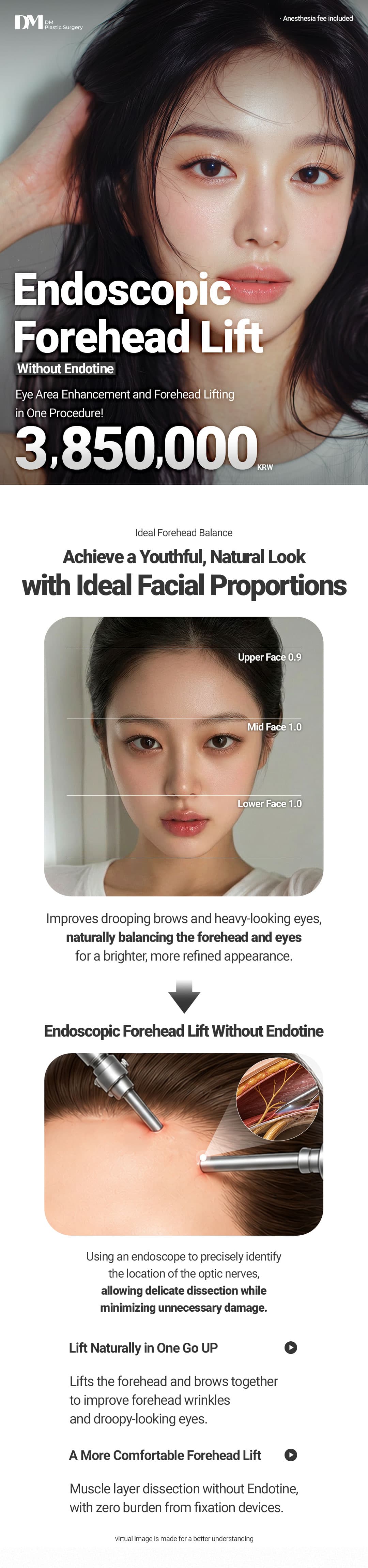 Endoscopic Forehead Lifting 2