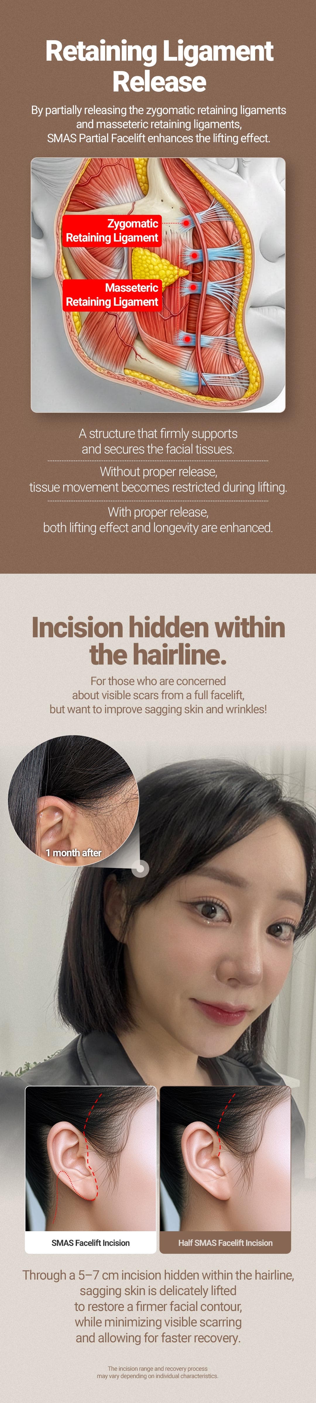 Half Face Lift 5
