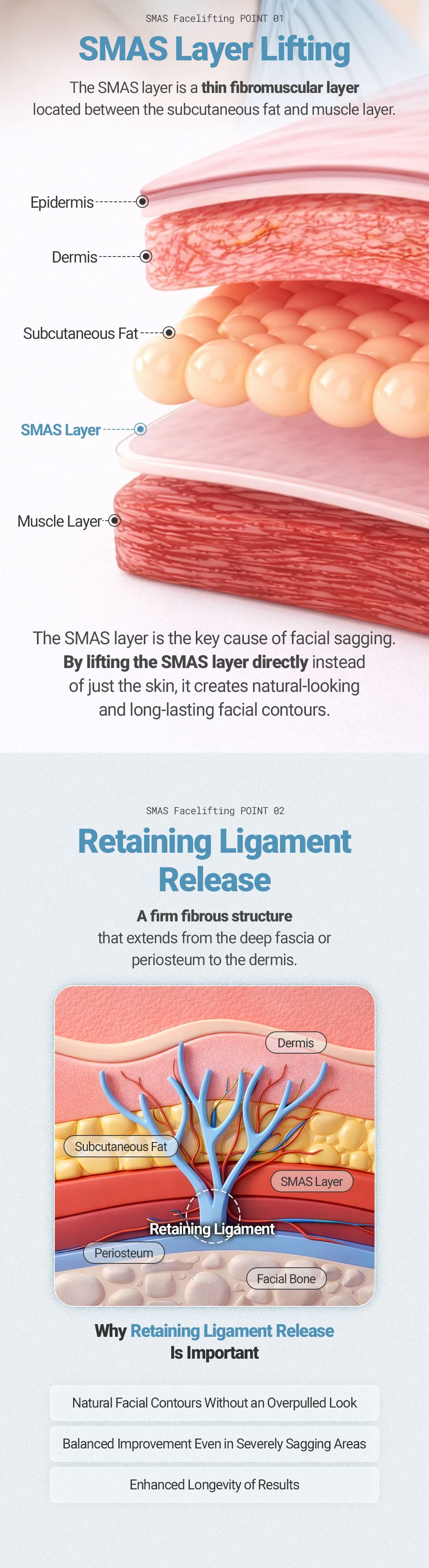 SMAS Facelift 4