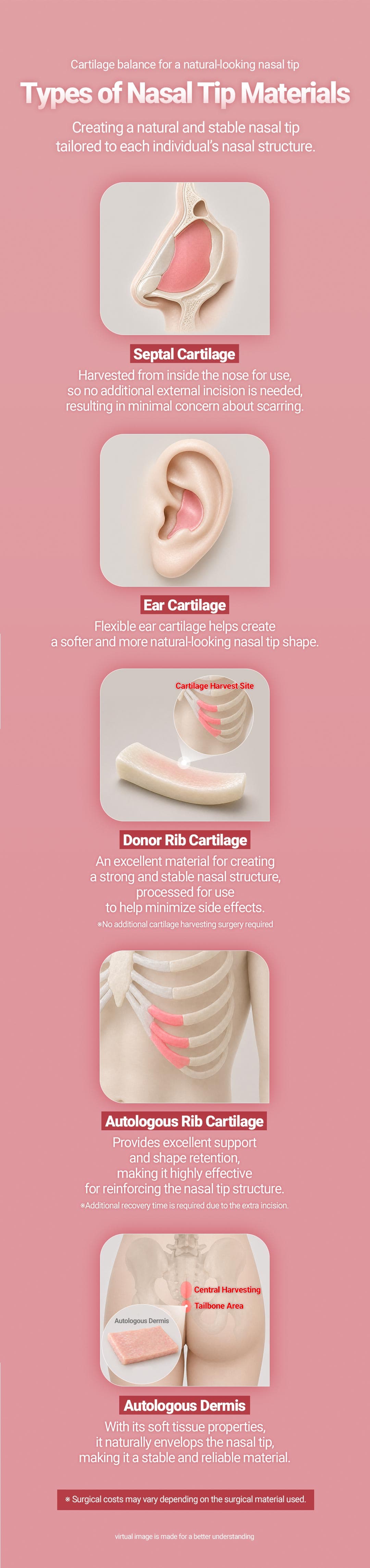 (First-time) Rhinoplasty 5