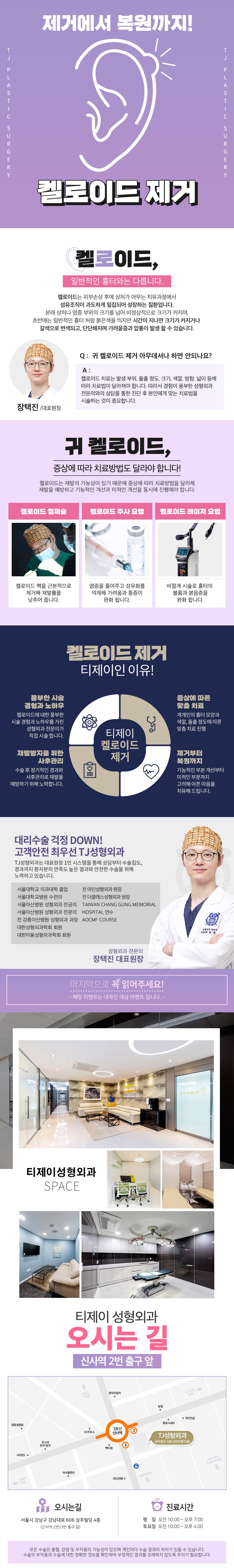 ทีเจกำจัดคีลอยด์ 1