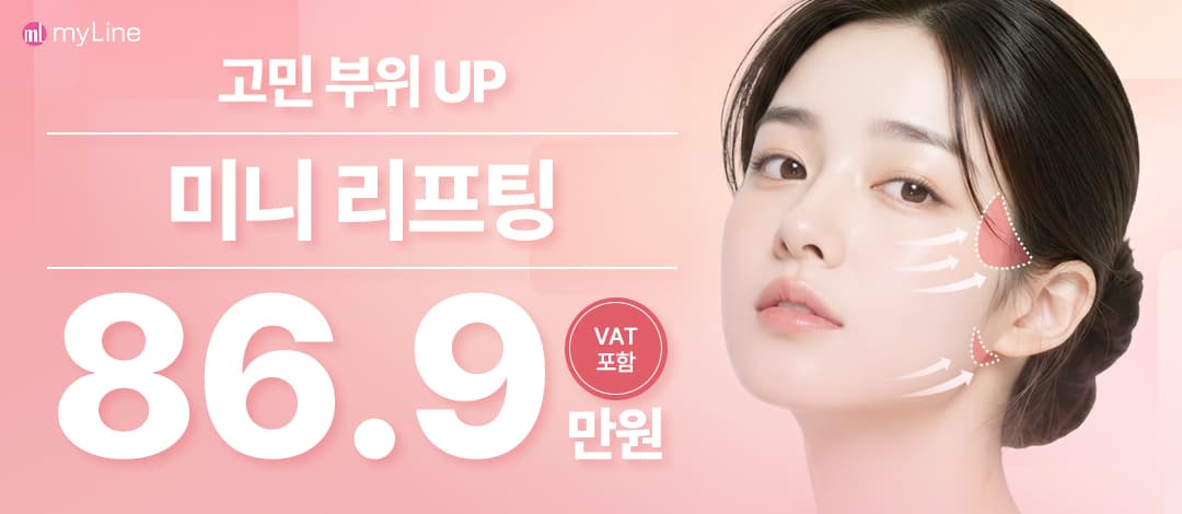 마이라인 미니리프팅