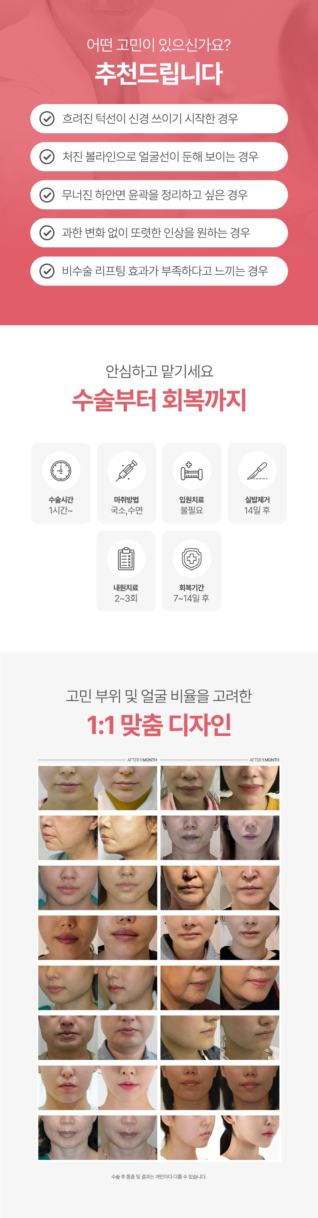 Mini Lifting Myline 3