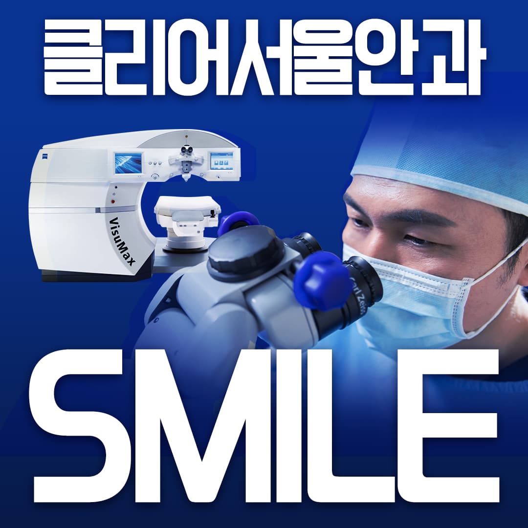 스마일라식