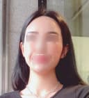 풀페이스 지방이식으로 얼굴 광명 찾았어요