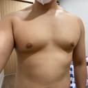 여유증 수술 이틀차인데 효과가 정말 놀랍습니다
