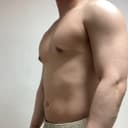 여유증 수술 받았습니다 벌써 만족스럽네요