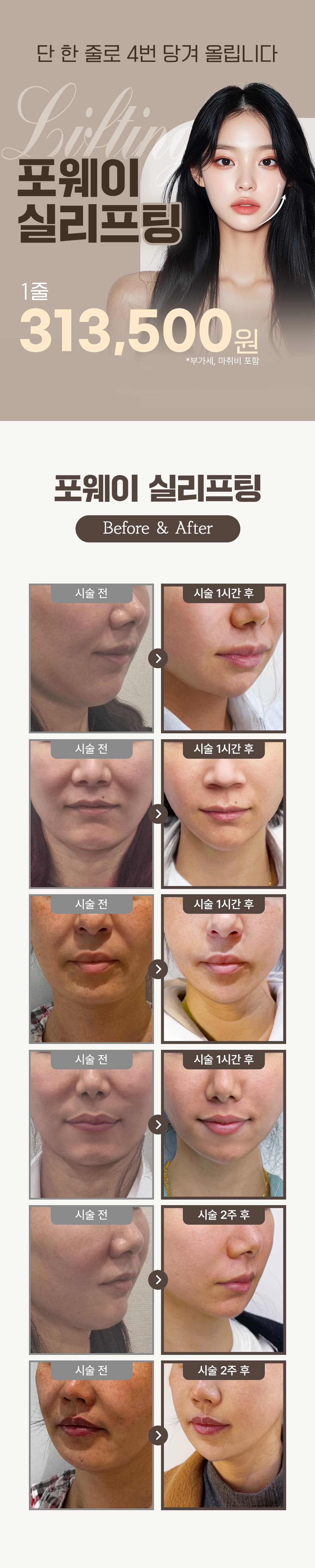 단 1줄로 4번 당겨 올리는 포웨이 실리프팅 1