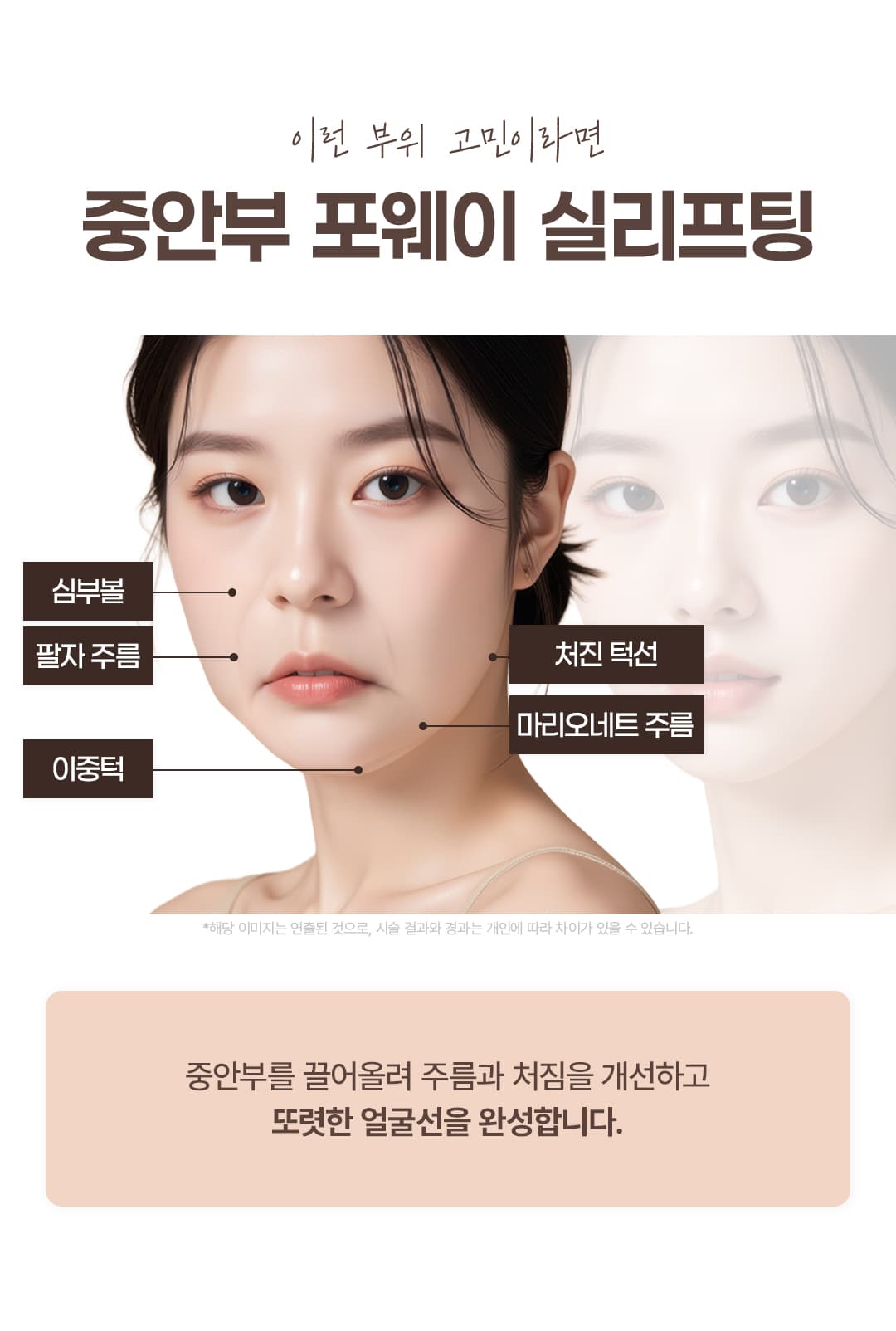 -중안부 실리프팅- 단 1줄로 4번 리프팅 하는 포웨이 실리프팅 2