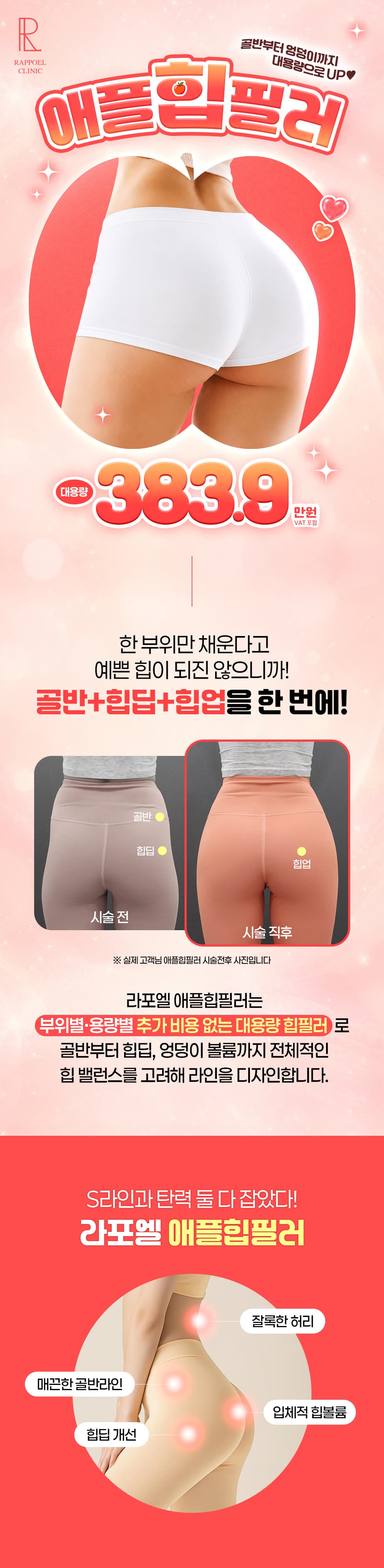 대용량 애플힙필러 - 골반필러,힙딥필러,힙업필러,엉덩이필러-라포엘의원 이주형 대표원장 1