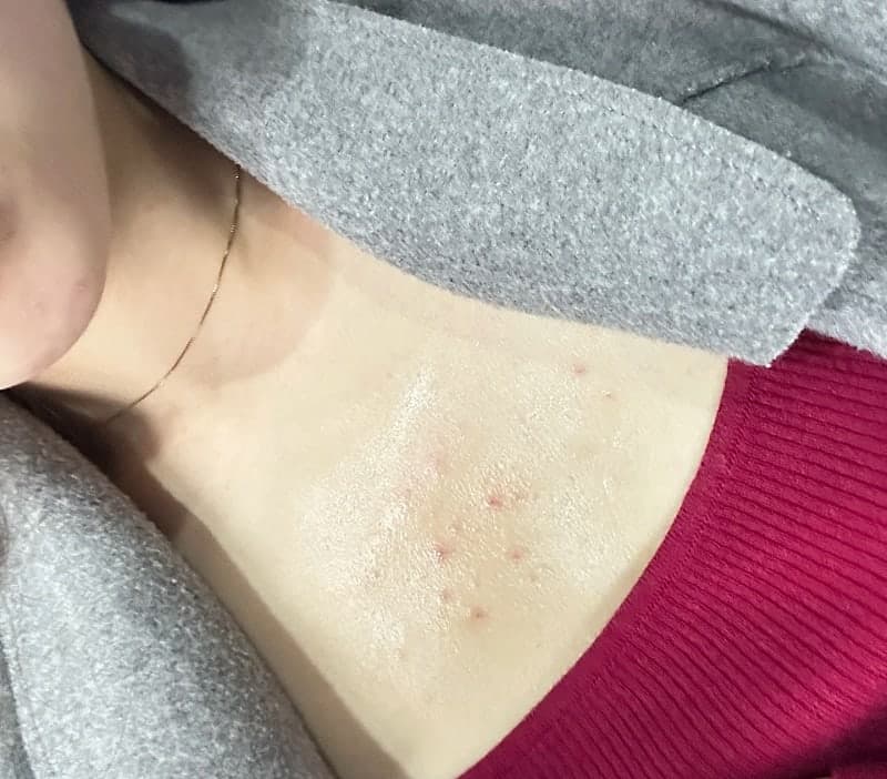 소독은 병원가서 받아야겠죠? 1