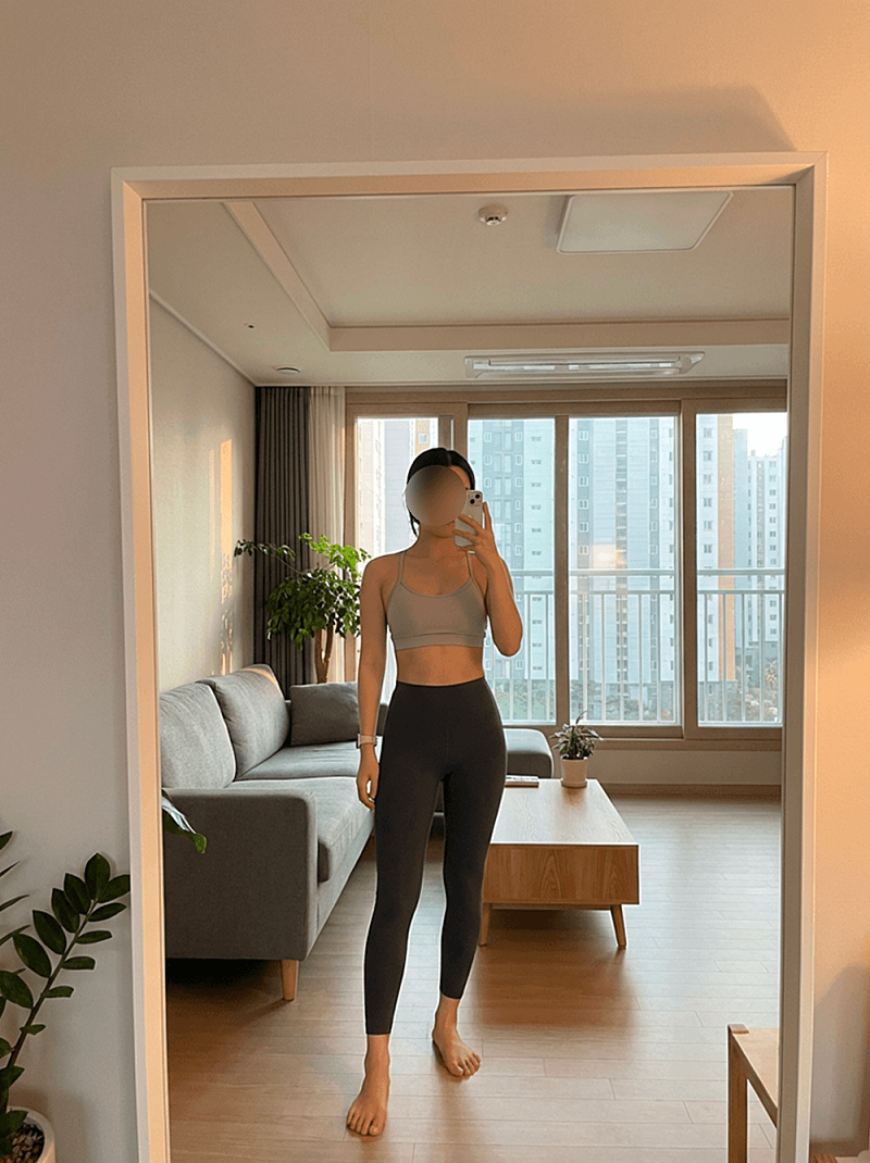 대구지방분해주사 팔뚝이랑 아랫배 여름 전에 해봤어요! 5