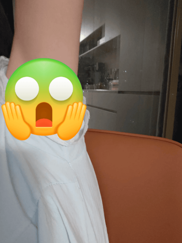 청주겨드랑이레이저제모 어디가 괜찮나요? 1