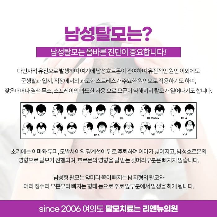여의도 탈모 복합치료가 중요한듯 4