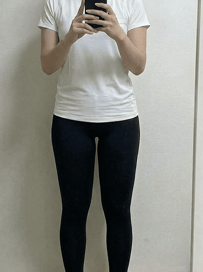 대구 달서구 다이어트 병원에서 허벅지 안쪽 정리했습니다! 1