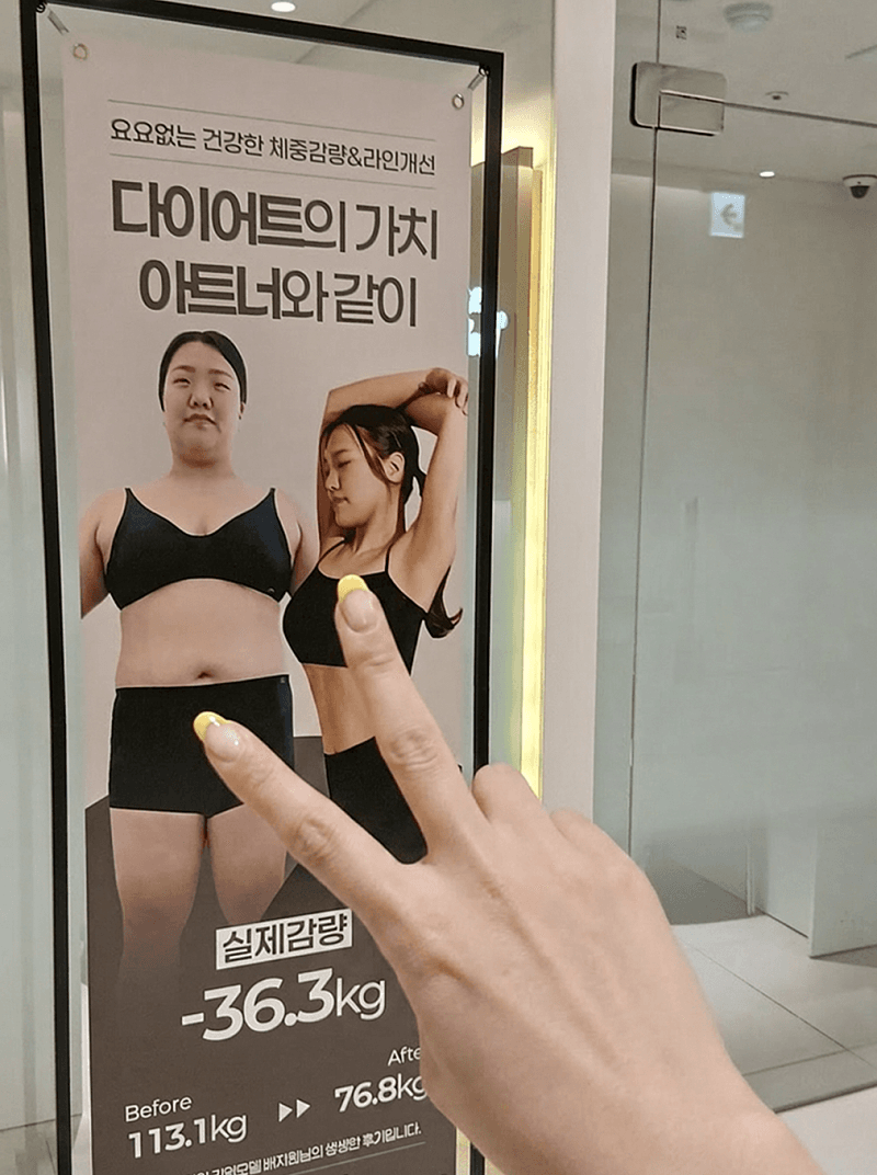 대구 달서구 다이어트 병원에서 허벅지 안쪽 정리했습니다! 2
