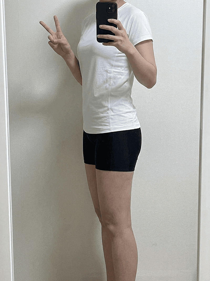 대구 달서구 다이어트 병원에서 허벅지 안쪽 정리했습니다! 6