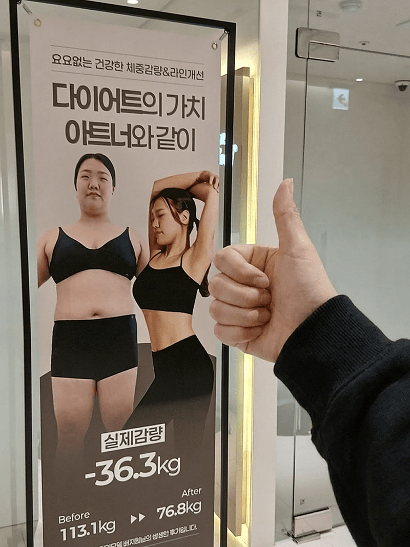 대구다이어트병원 여름전 팔뚝라인 정리 3