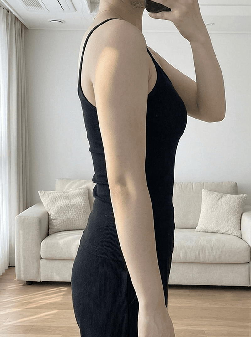 대구다이어트병원 여름전 팔뚝라인 정리 5