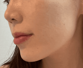 강남리쥬란 병원 잘 고르는 꿀팁! 1